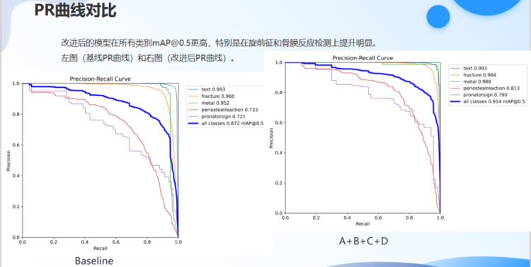 基于YOLO的医学影像骨折检测和诊断系统的设计与实现